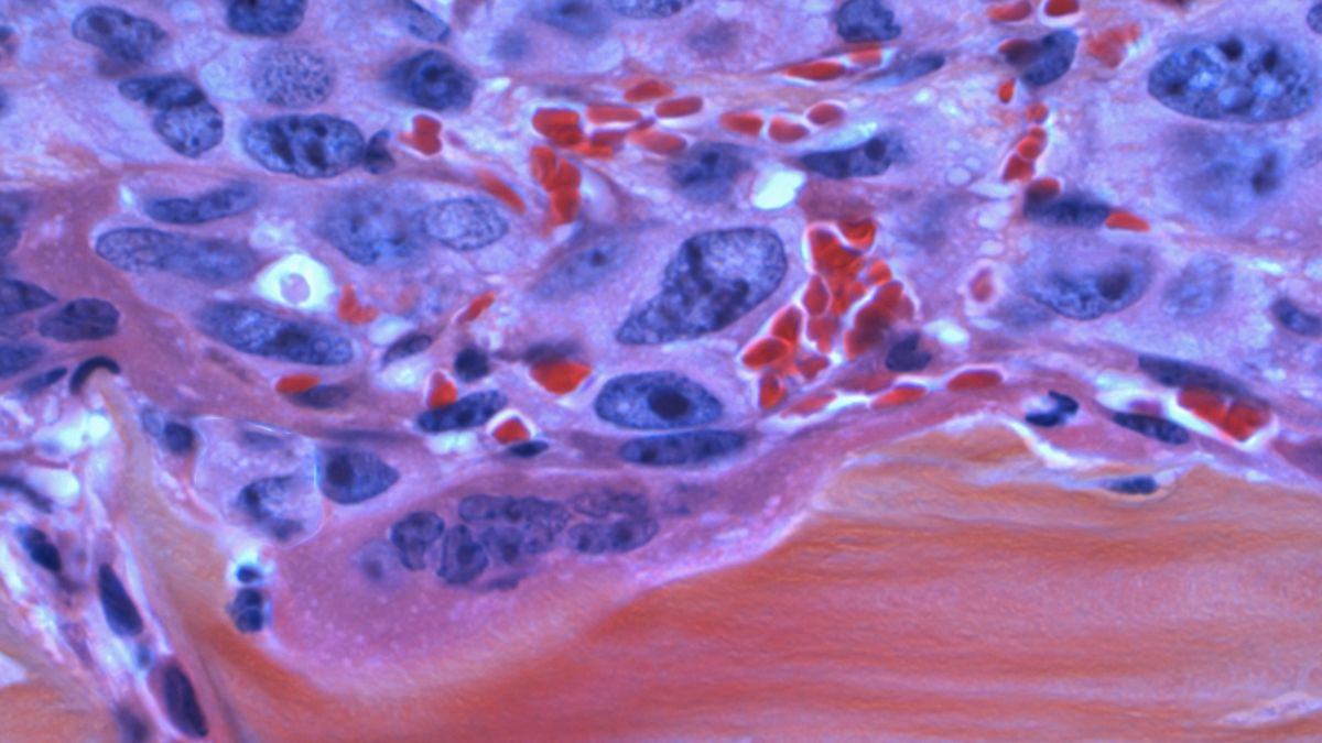 CIA in opspraak na herontdekking oud document over mogelijk kankergeneesmiddel.