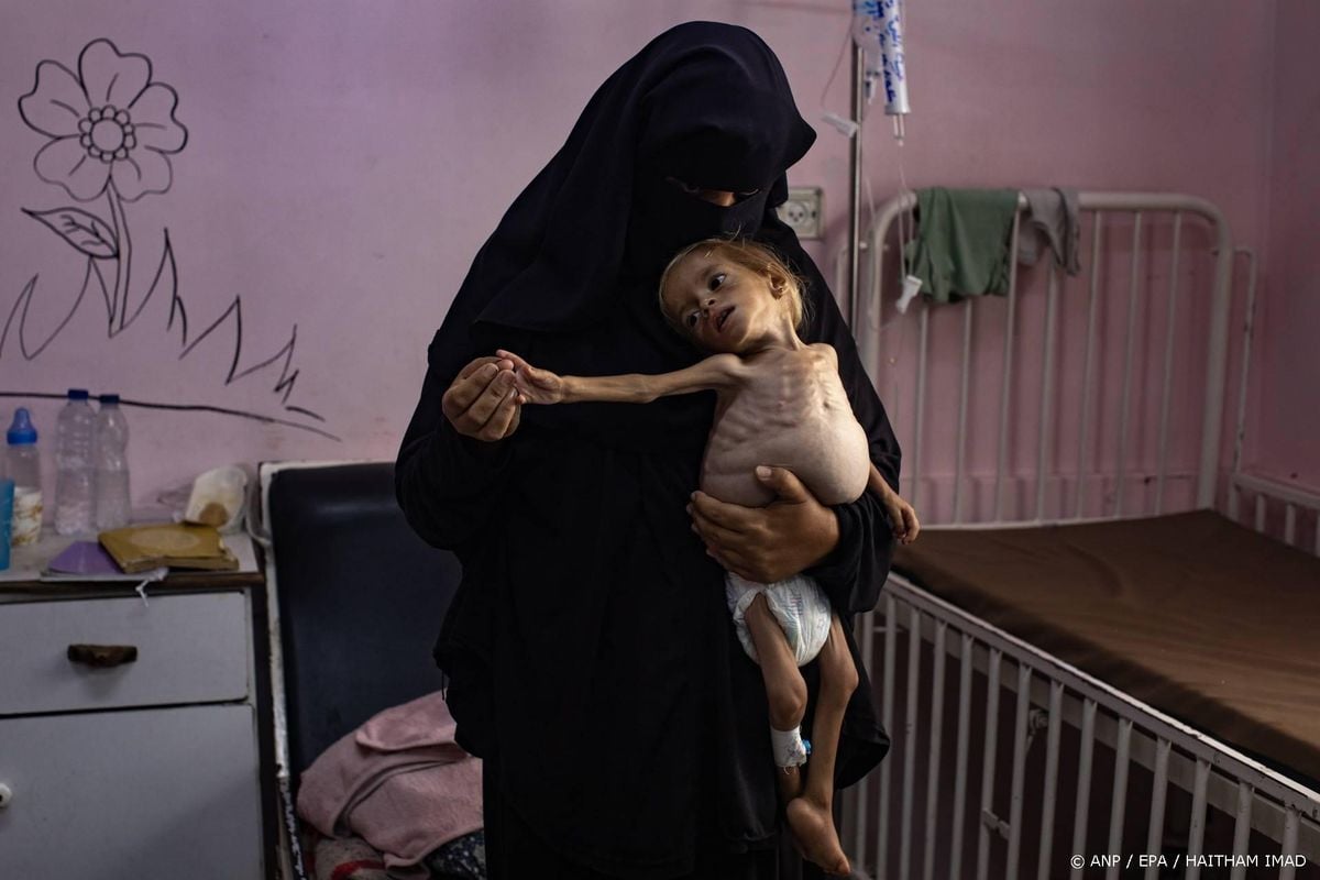 AzG: ondervoeding Gaza verwoestend voor zwangeren en baby's.